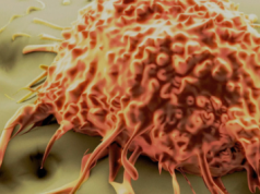 Why is cancer called cancer?